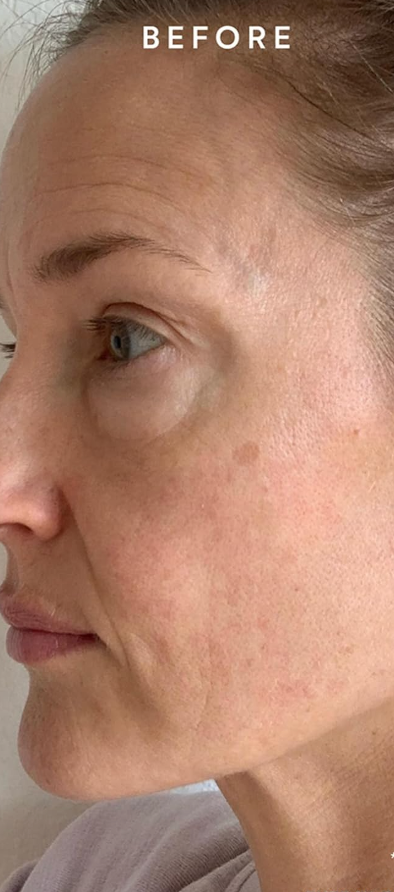 Before — Pre-Light result